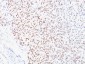  Microphthalmia Transcription Factor (MITF) Antibody - With BSA and Azide