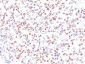  Microphthalmia Transcription Factor (MITF) Antibody - With BSA and Azide