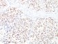  Microphthalmia Transcription Factor (MITF) Antibody - With BSA and Azide