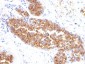  MUC1 / EMA / CD227 (Epithelial Marker) Antibody - With BSA and Azide