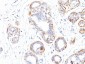  Smooth Muscle Myosin Heavy Chain (SM-MHC) (Leiomyosarcoma & Myoepithelial Cell Marker) Antibody - W
