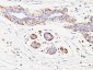  Smooth Muscle Myosin Heavy Chain (SM-MHC) (Leiomyosarcoma & Myoepithelial Cell Marker) Antibody - W