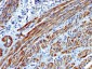  Smooth Muscle Myosin Heavy Chain (SM-MHC) (Leiomyosarcoma & Myoepithelial Cell Marker) Antibody - W