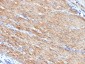  Smooth Muscle Myosin Heavy Chain (SM-MHC) (Leiomyosarcoma & Myoepithelial Cell Marker) Antibody - W