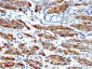  Smooth Muscle Myosin Heavy Chain (SM-MHC) (Leiomyosarcoma & Myoepithelial Cell Marker) Antibody - W