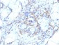  Smooth Muscle Myosin Heavy Chain (SM-MHC) (Leiomyosarcoma & Myoepithelial Cell Marker) Antibody - W