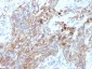  CD56 / NCAM1 / NKH1 (Neuronal Cell Marker) Antibody - With BSA and Azide