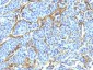  NGF-Receptor (p75) / CD271 (Soft Tissue Tumor Marker) Antibody - With BSA and Azide
