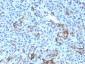  NGF-Receptor (p75) / CD271 (Soft Tissue Tumor Marker) Antibody - With BSA and Azide