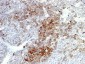  NGF-Receptor (p75) / CD271 (Soft Tissue Tumor Marker) Antibody - With BSA and Azide