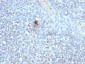  TRAcP (Tartrate-Resistant Acid Phosphatase) (Hairy Cell Leukemia Marker) Antibody - With BSA and Az