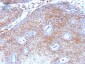  Beta-2 Microglobulin (Renal Failure & Tumor Marker) Antibody - With BSA and Azide