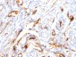  Beta-2 Microglobulin (Renal Failure & Tumor Marker) Antibody - With BSA and Azide