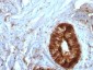 Beta-2 Microglobulin (Renal Failure & Tumor Marker) Antibody - With BSA and Azide