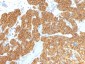  Parathyroid Hormone (PTH) (N-Terminal) Antibody - With BSA and Azide