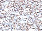  Actin, Smooth Muscle (Leiomyosarcoma Marker) Antibody - With BSA and Azide