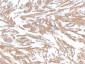  Actin, Smooth Muscle (Leiomyosarcoma Marker) Antibody - With BSA and Azide