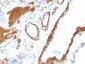  Actin, Smooth Muscle (Leiomyosarcoma Marker) Antibody - With BSA and Azide