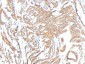  Actin, Smooth Muscle (Leiomyosarcoma Marker) Antibody - With BSA and Azide