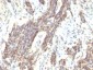  Cyclin D1 (G1-Cyclin & Mantle Cell Marker) Antibody - With BSA and Azide