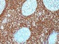  Bcl-2 (Apoptosis & Follicular Lymphoma Marker) Antibody - With BSA and Azide