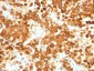  gp100 / Melanosome / PMEL17 / SILV (Melanoma Marker) Antibody - With BSA and Azide