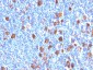  Fascin-1 (Reed-Sternberg Cell Marker) Antibody - With BSA and Azide