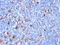  Fascin-1 (Reed-Sternberg Cell Marker) Antibody - With BSA and Azide