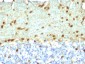  Fascin-1 (Reed-Sternberg Cell Marker) Antibody - With BSA and Azide