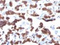  Thyroglobulin (Thyroidal Cell Marker) Antibody - With BSA and Azide