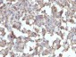  TNF-alpha (Tumor Necrosis Factor alpha) Antibody - With BSA and Azide