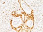  p53 Tumor Suppressor Protein Antibody - With BSA and Azide