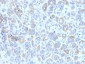  Tyrosinase-Related Protein-1 (TYRP-1) (Melanoma Marker) Antibody - With BSA and Azide