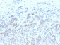  Tyrosinase-Related Protein-1 (TYRP-1) (Melanoma Marker) Antibody - With BSA and Azide