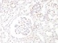  Wilm's Tumor 1 (WT1) (Wilm's Tumor & Mesothelial Marker) Antibody - With BSA and Azide