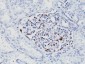  Wilm's Tumor 1 (WT1) (Wilm's Tumor & Mesothelial Marker) Antibody - With BSA and Azide