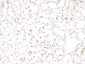  Wilm's Tumor 1 (WT1) (Wilm's Tumor & Mesothelial Marker) Antibody - With BSA and Azide