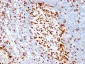  ZAP70 (Chronic Lymphocytic Leukemia Marker) Antibody - With BSA and Azide