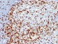  ZAP70 (Chronic Lymphocytic Leukemia Marker) Antibody - With BSA and Azide
