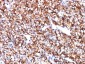 Carbonic Anhydrase IX (Renal Cell Marker) Antibody - With BSA and Azide