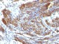  Caldesmon, HMW (h-Caldesmon) (Smooth Muscle Marker) Antibody - With BSA and Azide