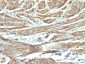  Caldesmon, HMW (h-Caldesmon) (Smooth Muscle Marker) Antibody - With BSA and Azide