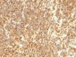  CD20 / MS4A1 (B-Cell Marker) Antibody - Culture Supernatant 
