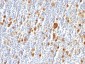  CD30 / TNFRSF8 (Hodgkin & Reed-Sternberg Cell Marker) Antibody - Culture Supernatant 