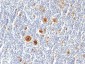 CD30 / TNFRSF8 (Hodgkin & Reed-Sternberg Cell Marker) Antibody - With BSA and Azide