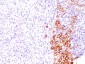  CD30 / TNFRSF8 (Hodgkin & Reed-Sternberg Cell Marker) Antibody - With BSA and Azide