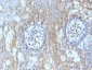  CD59 / Complement Regulatory Protein / Protectin Antibody - With BSA and Azide