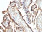  HCG Holo (Pregnancy & Choriocarcinoma Marker) Antibody - With BSA and Azide