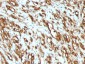  Actin, Muscle Specific (Muscle Cell Marker) Antibody - With BSA and Azide