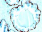  Cytokeratin, Basic (Type II or HMW) (Epithelial Marker) Antibody - With BSA and Azide